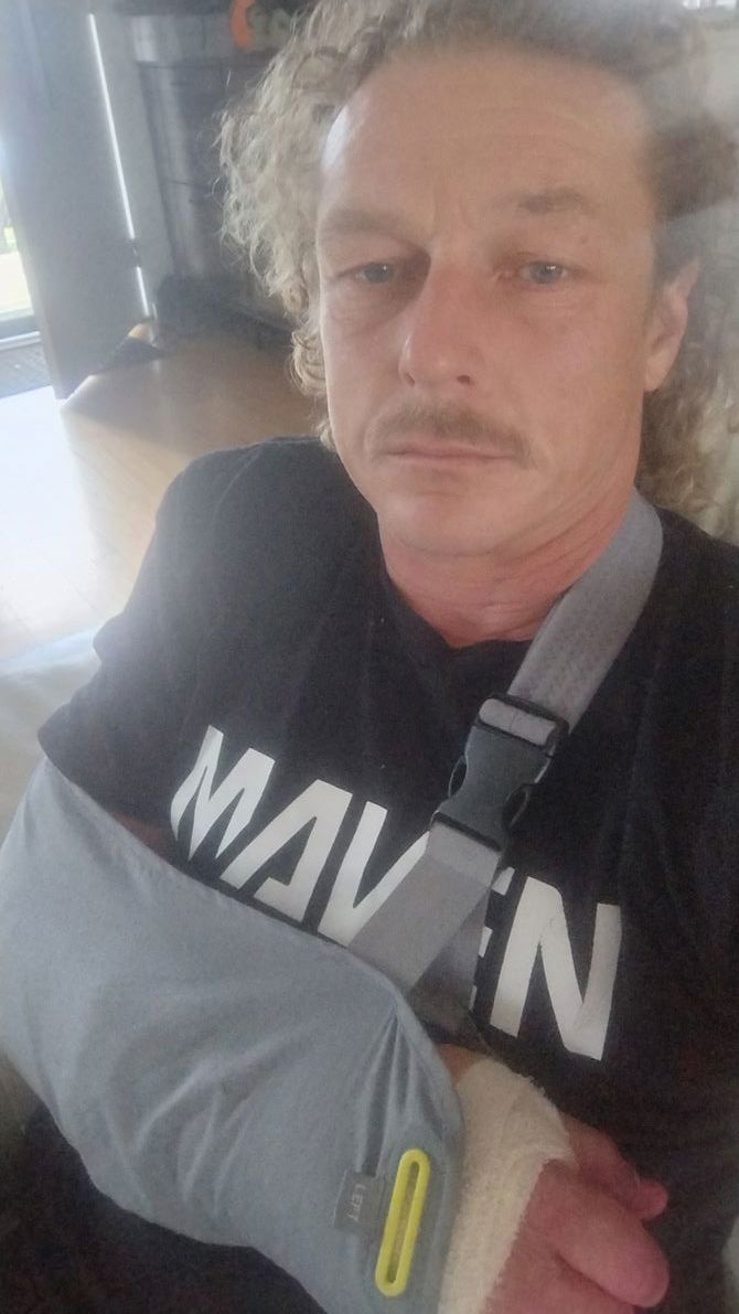 Hand surgery 17/10/25